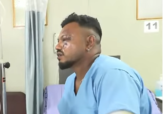 Post-Traumatic Stress Disorder in Air India crash survivor Vishwash Kumar Ramesh